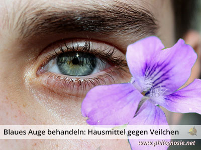 blaues Auge behandeln, Veilchen 