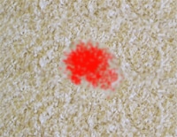 Blut aus Teppich entfernen