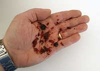 Hande Reinigen 8 Tipps Flecken Und Schmutz Zu Entfernen Philognosie