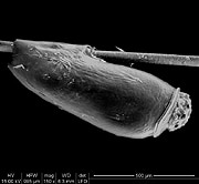 Pediculus humanus var capitis gegen Kopfläuse bekämpfen