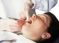 Dentalphobie Panik Therapie Zahnarzt