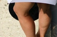 gegen Cellulite orangenhaut