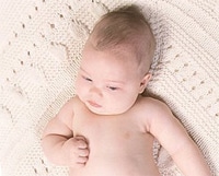 Milchschorf Baby entfernen behandeln