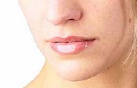 mundpflege mit Vaseline