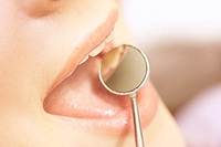 Zahnpflege - Paradontitis erkennen