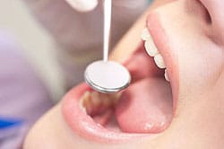 Zahnreinigung beim Zahnarzt